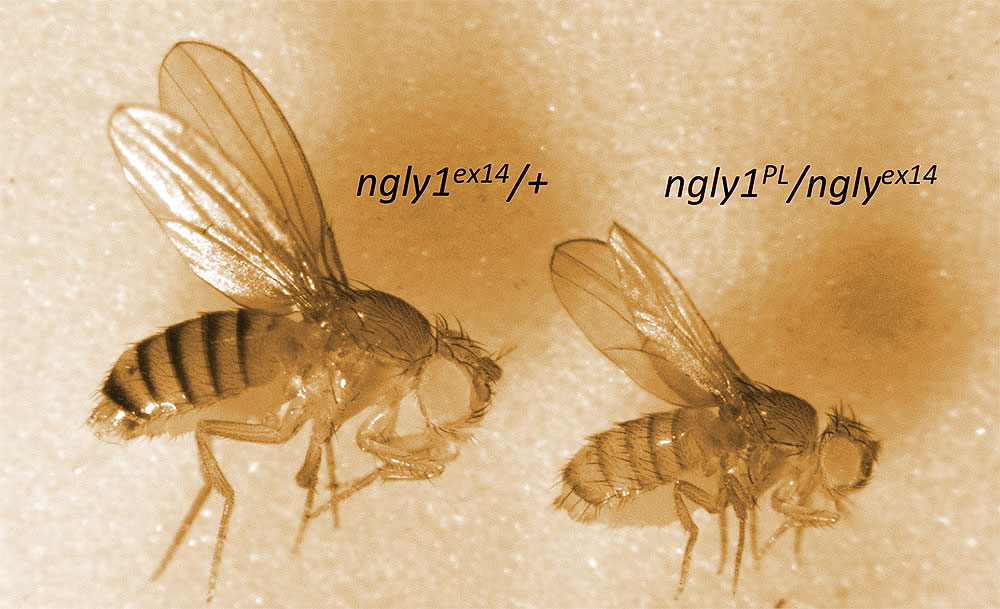 Fly models of NGLY1 Deficiency